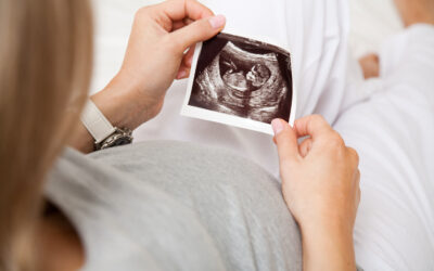 Understanding the Nuchal Translucency Scan: What to Expect During Your First Trimester