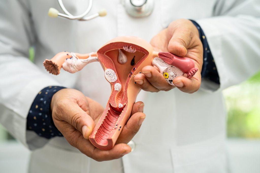 doctor holding an anatomy model of a uterus for study