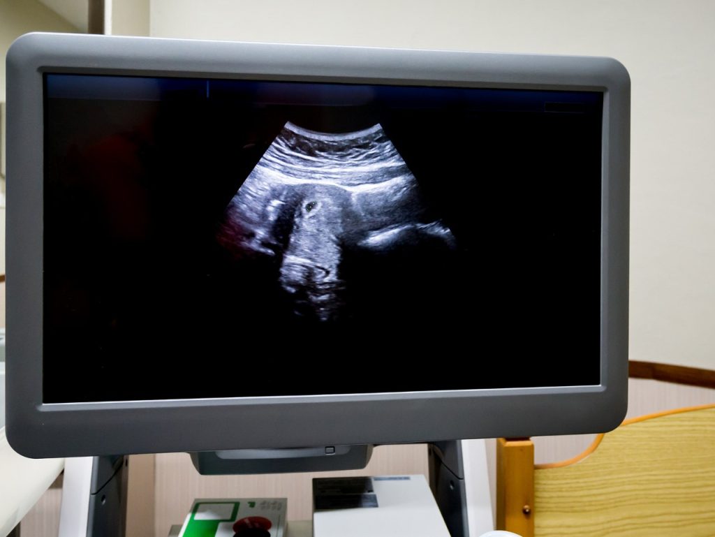 
medical ultrasound machine in hospital diagnostic room